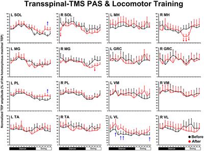 Brain and spinal cord paired stimulation coupled with locomotor training facilitates motor output in human spinal cord injury